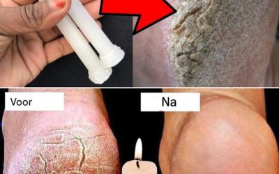 Innovatieve nachtbehandeling: verzacht je voeten met een verrassend element.
